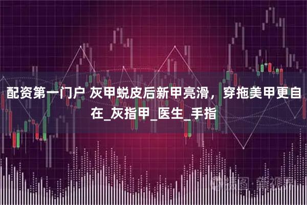配资第一门户 灰甲蜕皮后新甲亮滑，穿拖美甲更自在_灰指甲_医生_手指